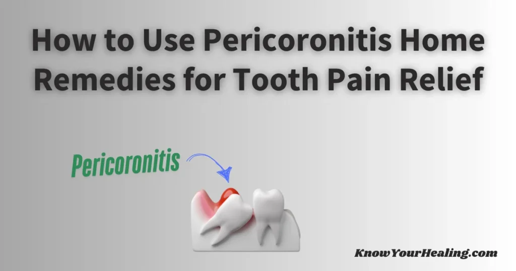 Pericoronitis home remedies