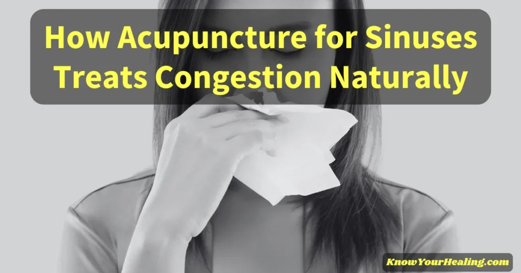 acupuncture for sinuses