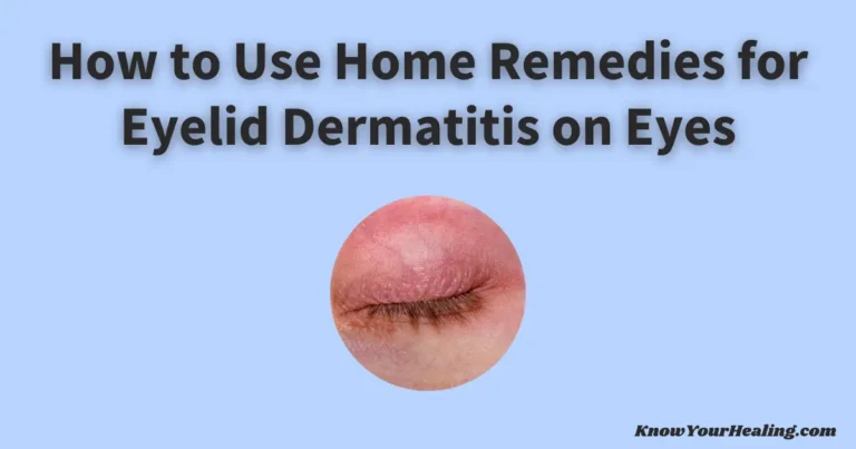 home remedies for eyelid dermatitis