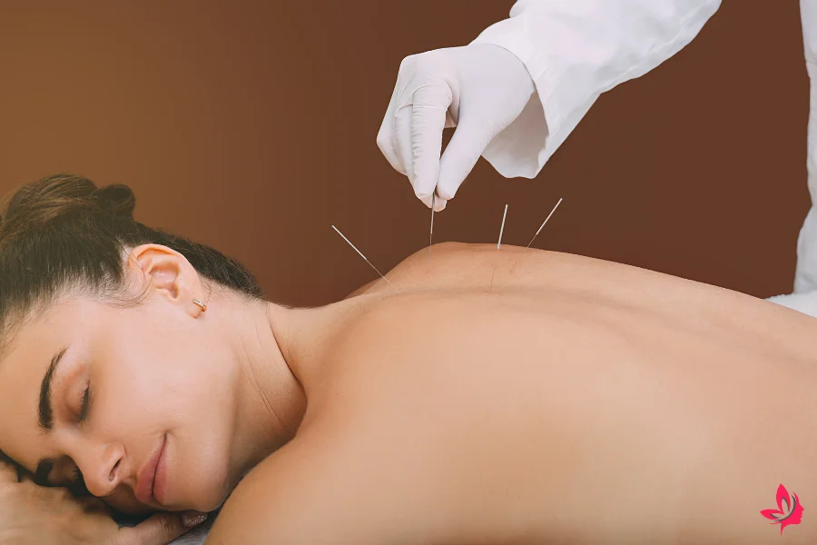acupuncture for reflux