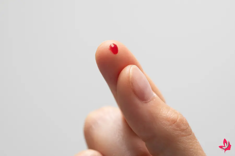 dream of bleeding
