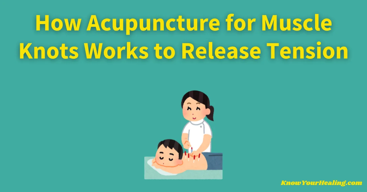acupuncture for muscle knots